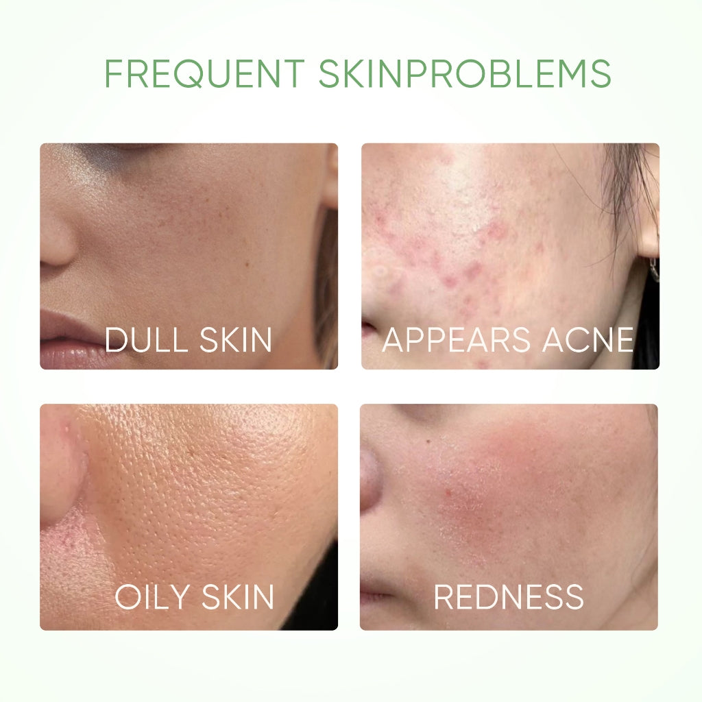 MUGWORT ACNE CLAY MASK STICK