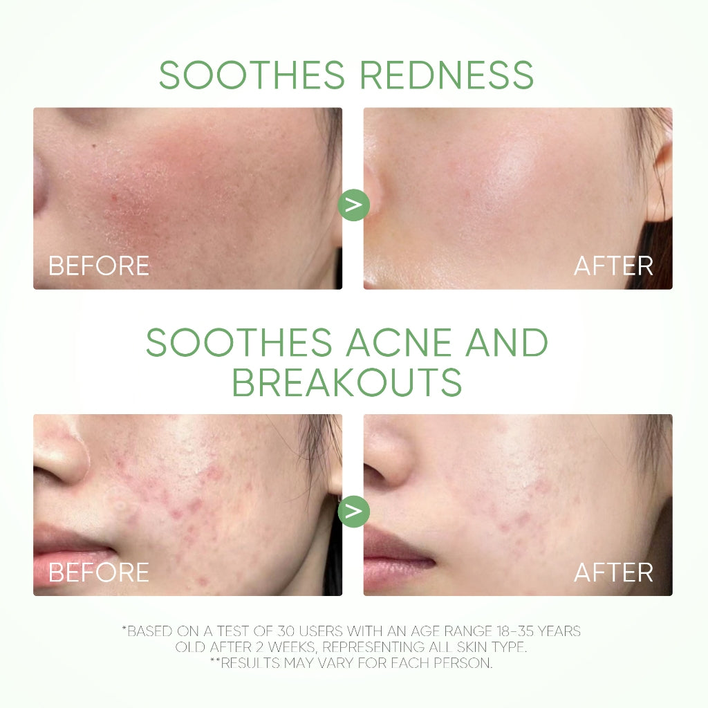 MUGWORT ACNE CLAY MASK STICK